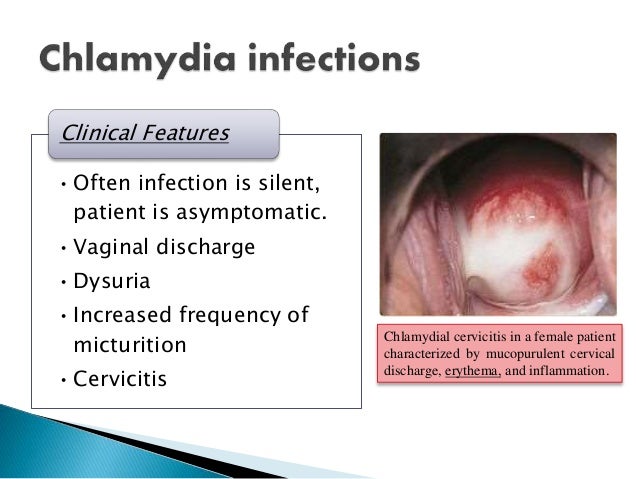 vulva inflamation pictures Vulva inflamation pictures
